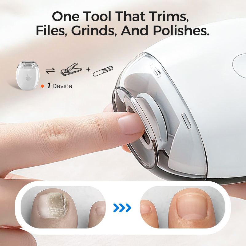 🎁Last Day Sale 70% OFF🥳💞50K+ SOLD!⚡Universal Automatic Fingernail Grinder for Adults and Children